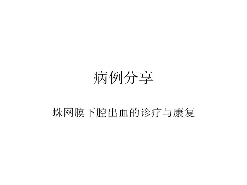 蛛网膜下腔出血病例分享