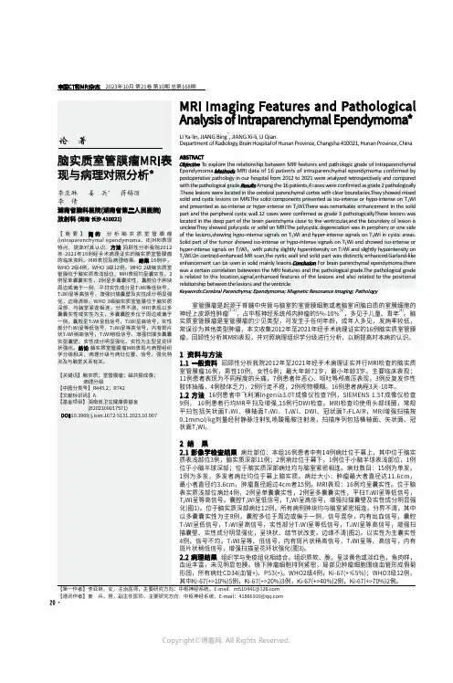 脑实质室管膜瘤MRI表现与病理对照分析