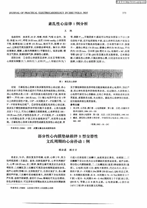 部分性心内膜垫缺损伴B型交替性文氏周期的心房扑动1例