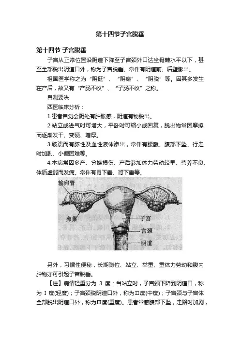 第十四节子宫脱垂