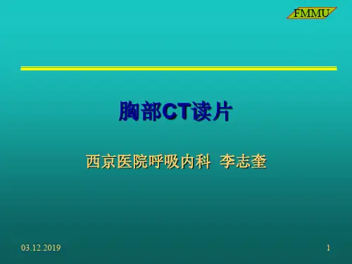 CT读片-胸部 65页