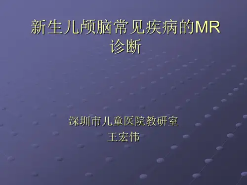 新生儿颅脑常见疾病的MR诊断