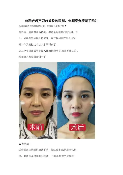 热玛吉超声刀热提拉的区别,你到底分清楚了吗？