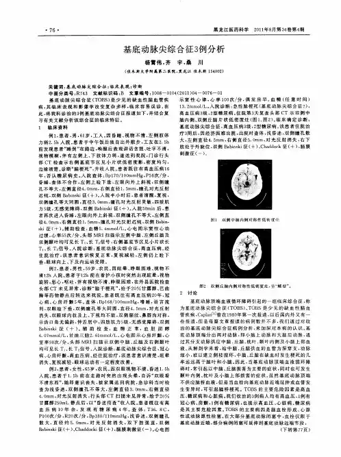 基底动脉尖综合征3例分析