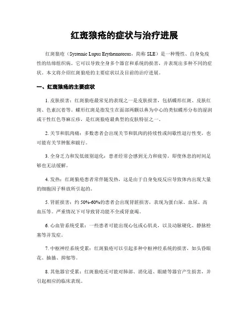红斑狼疮的症状与治疗进展