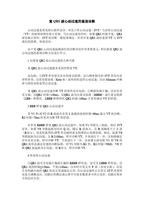 宽QRS波心动过速的鉴别诊断