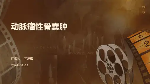 动脉瘤性骨囊肿