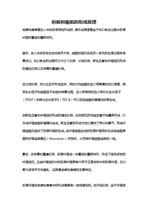 疤痕和瘢痕的形成原理