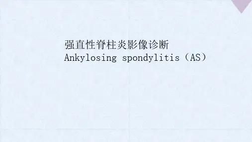 强直性脊柱炎影像诊断