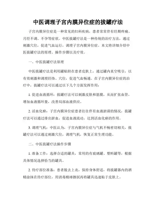 中医调理子宫内膜异位症的拔罐疗法
