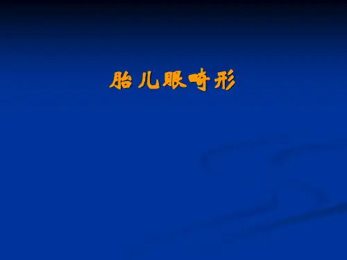 胎儿眼畸形课件