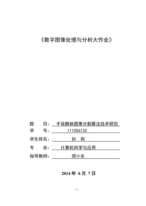 手背静脉图像分割算法技术研究