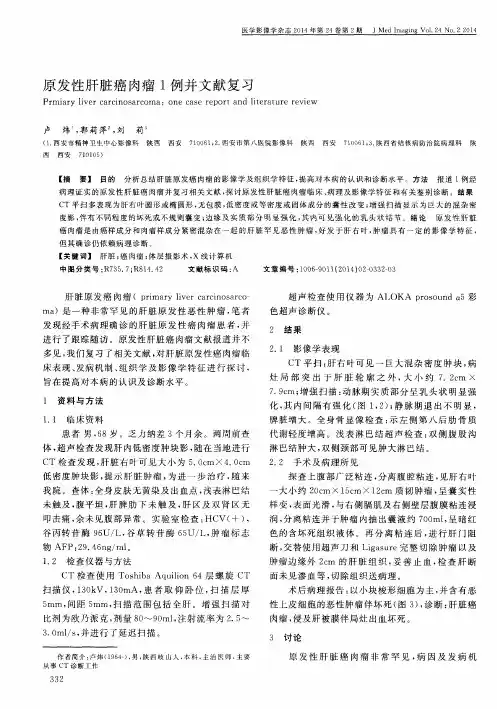 原发性肝脏癌肉瘤1例并文献复习