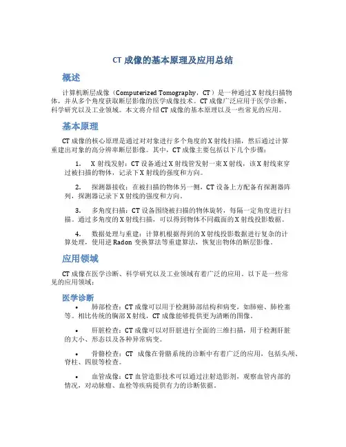 ct成像的基本原理及应用总结