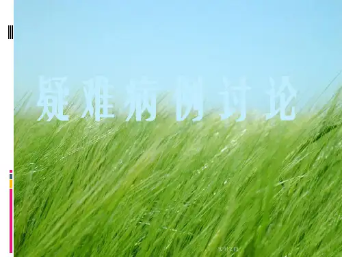 病例讨论多发性骨髓瘤ppt课件