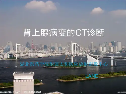 肾上腺病变CT诊断