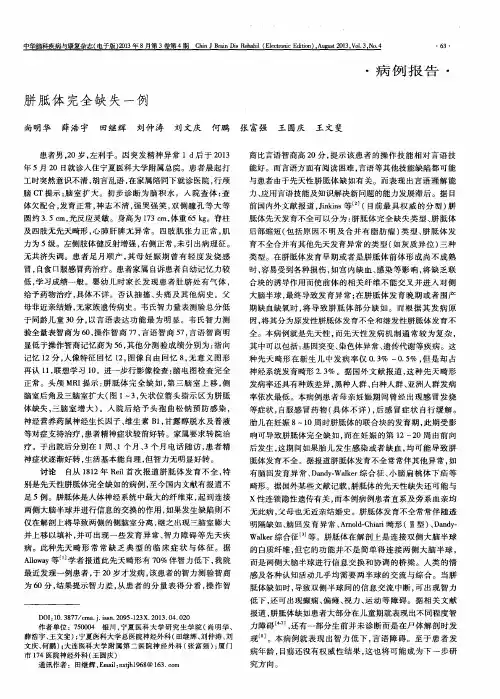 胼胝体完全缺失一例
