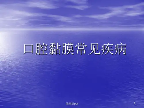 口腔黏膜常见疾病PPT课件