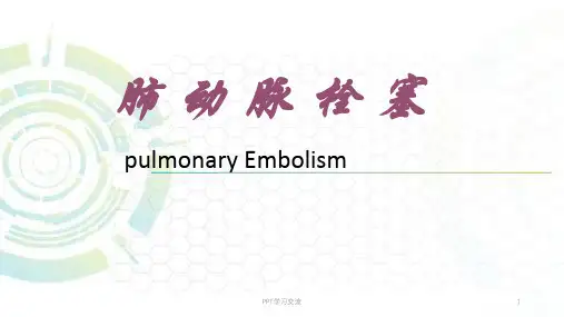 肺动脉栓塞ppt课件