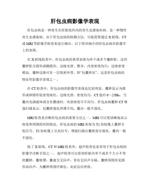 肝包虫病影像学表现