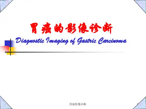 胃癌影像诊断ppt课件