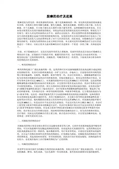 股癣的治疗及进展
