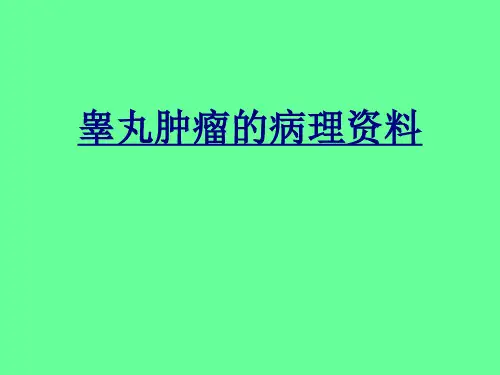 睾丸肿瘤的病理资料