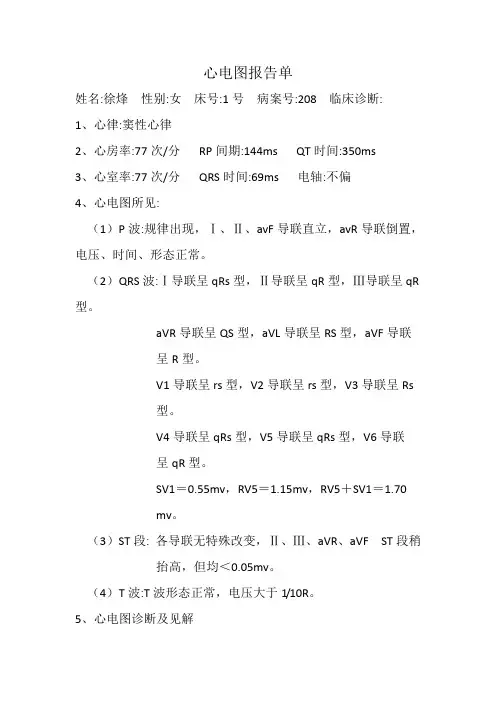 心电图报告单