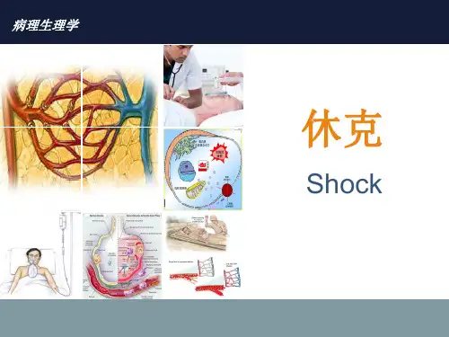 病理生理学——休克