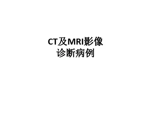 CT及MRI影像诊断病例ppt课件