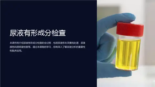 《尿液有形成分检查》课件