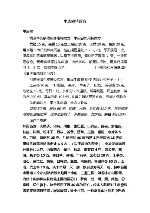 牛皮癣特效方