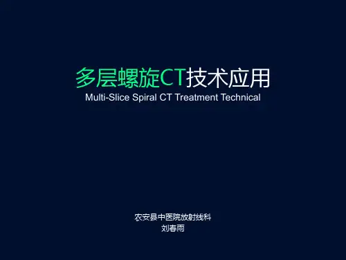 多层螺旋CT技术应用