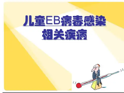 儿童EB病毒感染相关疾病PPT课件