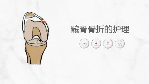 髌骨骨折的护理【最新版】