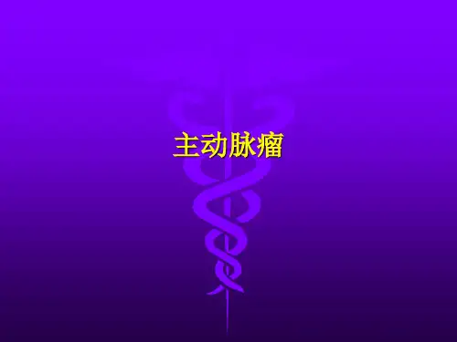 主动脉瘤