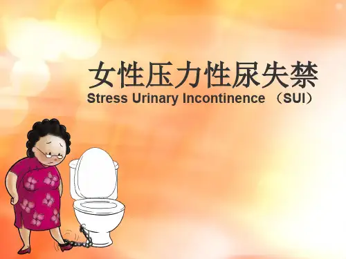 女性压力性尿失禁 ppt课件