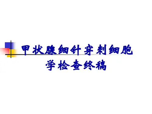 甲状腺细针穿刺细胞学检查终稿