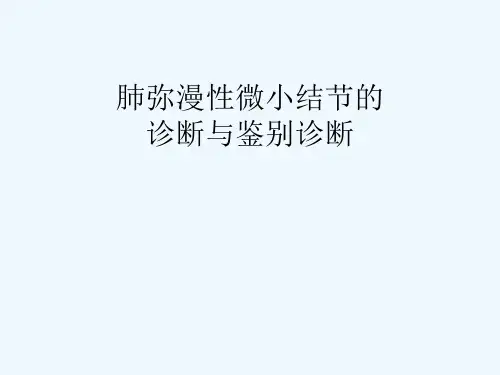 肺弥漫微小结节诊断与鉴别诊断