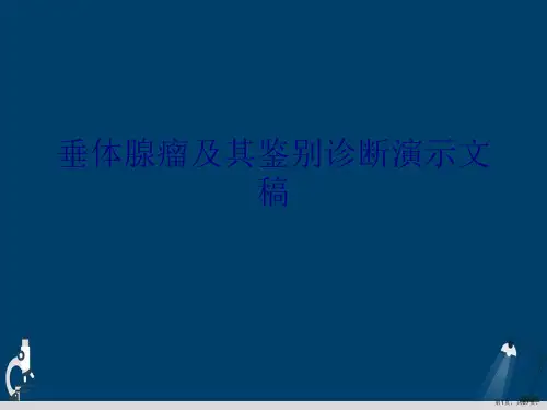 垂体腺瘤及其鉴别诊断演示文稿