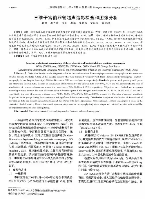 三维子宫输卵管超声造影检查和图像分析