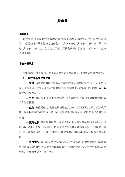 肠套叠