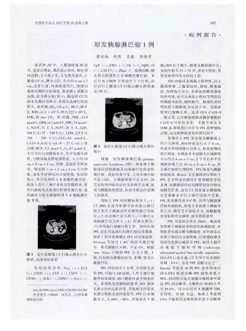 原发胰腺淋巴瘤1例
