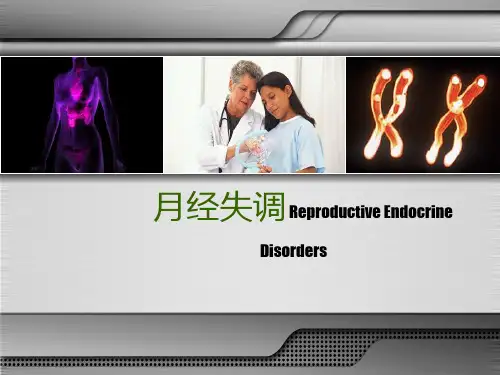 月经失调PPT课件