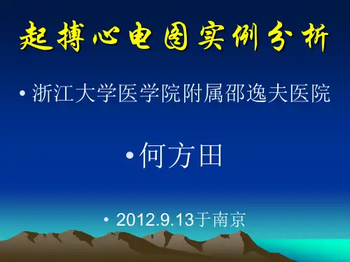[PPT]起搏心电图实例分析