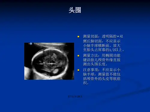 产科超声标准切面张图教案