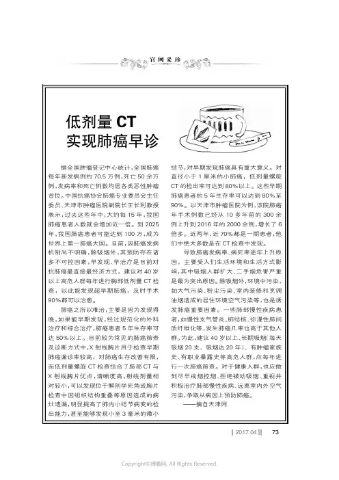 低剂量CT实现肺癌早诊