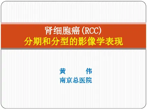 医学影像-肾细胞癌分期和分型的影像学表现