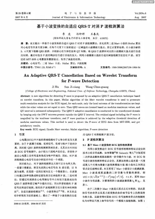 基于小波变换的自适应QRS-T对消P波检测算法
