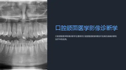 口腔颌面医学影像诊断学